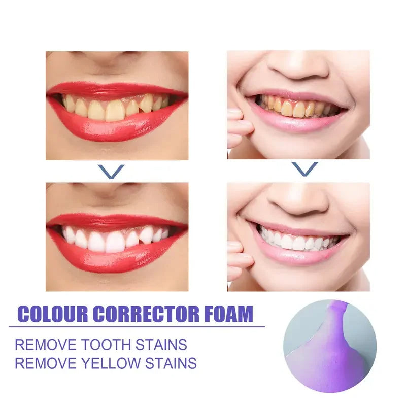 TEETH WHITENING PEN